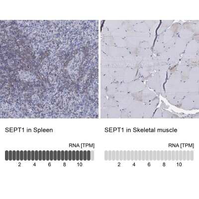 Immunocytochemistry/ Immunofluorescence: Septin-1 Antibody [NBP3-17043]