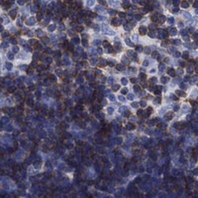 Immunohistochemistry-Paraffin: Septin-1 Antibody [NBP3-17043]