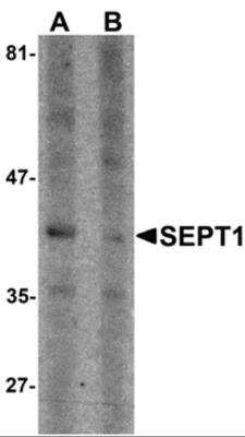 Western Blot: Septin-1 AntibodyBSA Free [NBP2-81892]