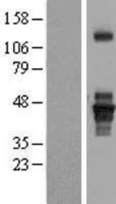 Western Blot: Septin-1 Overexpression Lysate [NBL1-07139]