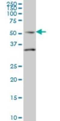 Western Blot: Septin-10 Antibody (2A12) [H00151011-M01]