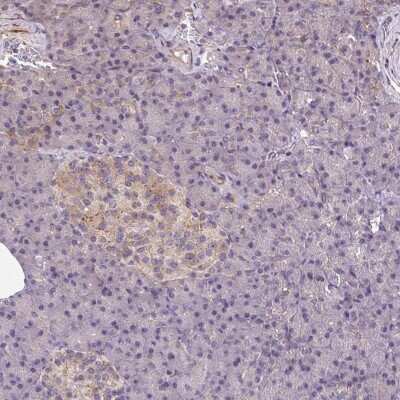 Immunohistochemistry-Paraffin: Septin-10 Antibody [NBP2-49221]