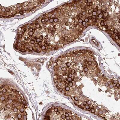 Immunohistochemistry-Paraffin: Septin-10 Antibody [NBP2-49221]