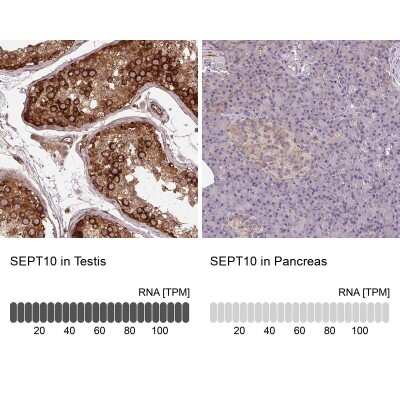 Immunohistochemistry-Paraffin: Septin-10 Antibody [NBP2-49221]