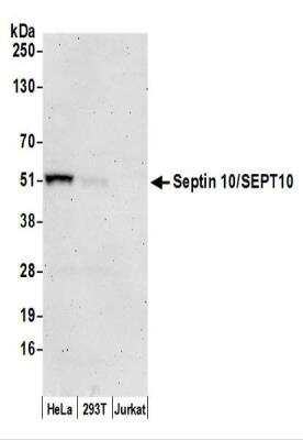 Western Blot: Septin-10 Antibody [NBP2-44287]