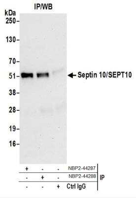 Western Blot: Septin-10 Antibody [NBP2-44287]