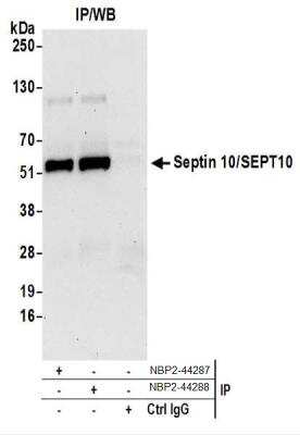 Western Blot: Septin-10 Antibody [NBP2-44288]