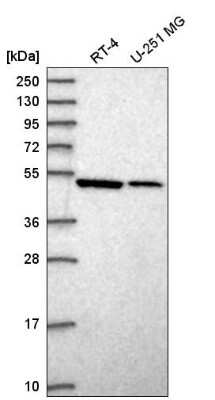 Western Blot: Septin-10 Antibody [NBP2-56906]