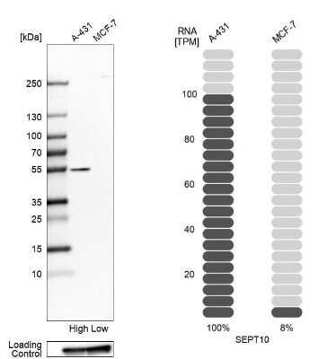 Western Blot: Septin-10 Antibody [NBP2-56906]