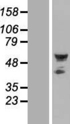 Western Blot: Septin-10 Overexpression Lysate [NBL1-07151]