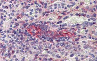 Immunohistochemistry-Paraffin: Septin-11 Antibody [NBP1-58144]