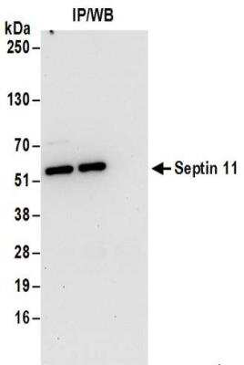 Immunoprecipitation: Septin-11 Antibody [NBP2-32159]
