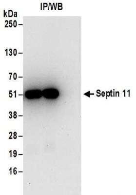 Immunoprecipitation: Septin-11 Antibody [NBP2-32160]
