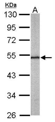 Western Blot: Septin-11 Antibody [NBP1-31717]