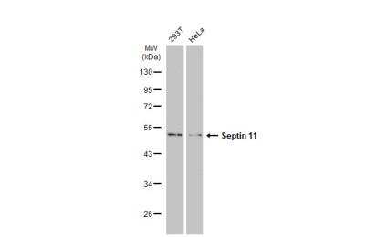 Western Blot: Septin-11 Antibody [NBP1-31717]