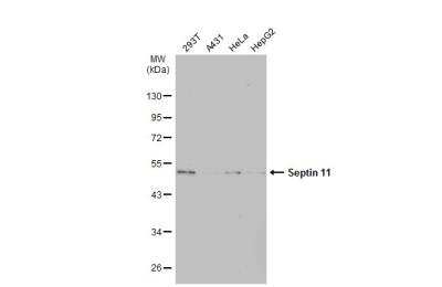 Western Blot: Septin-11 Antibody [NBP1-31717]