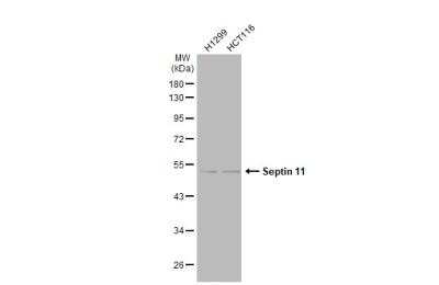 Western Blot: Septin-11 Antibody [NBP1-31717]