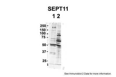 Western Blot: Septin-11 Antibody [NBP1-58144]