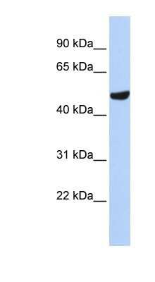 Western Blot: Septin-11 Antibody [NBP1-58144]