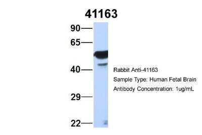 Western Blot: Septin-11 Antibody [NBP1-58144]