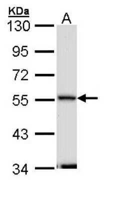 Western Blot: Septin-11 Antibody [NBP2-20299]