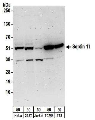 Western Blot: Septin-11 Antibody [NBP2-32159]