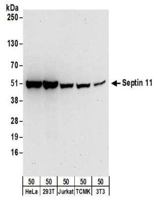 Western Blot: Septin-11 Antibody [NBP2-32160]