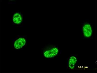 Immunocytochemistry/ Immunofluorescence: Septin-12 Antibody [H00124404-B01P]