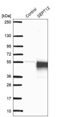 Western Blot: Septin-12 Antibody [NBP1-91640]