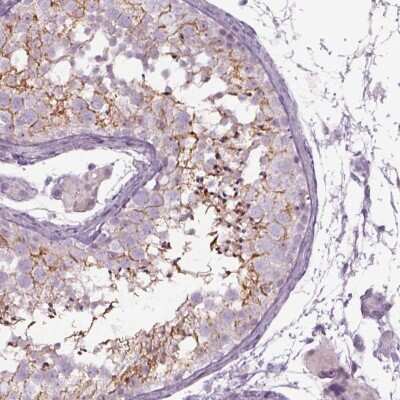 Immunohistochemistry-Paraffin: Septin-14 Antibody [NBP2-57892]