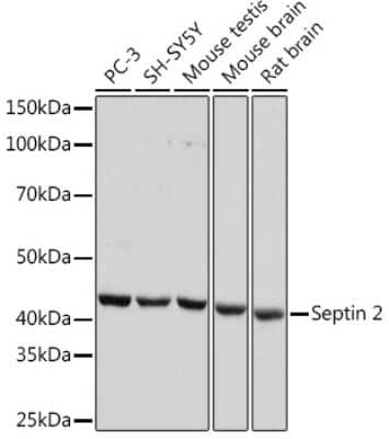 Western Blot: Septin-2 Antibody (9N1B3) [NBP3-16653]