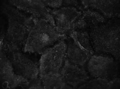 Immunocytochemistry/ Immunofluorescence: Septin-2 Antibody [NBP1-85212]