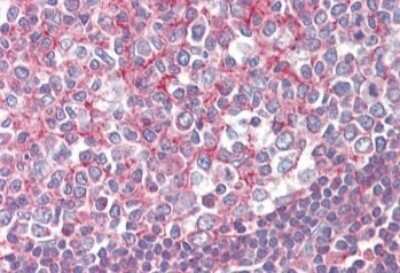 Immunohistochemistry-Paraffin: Septin-2 Antibody [NBP1-06076]