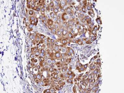 Immunohistochemistry-Paraffin: Septin-2 Antibody [NBP1-31496]
