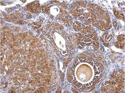 Immunohistochemistry-Paraffin: Septin-2 Antibody [NBP1-31496]