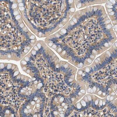 Immunohistochemistry-Paraffin: Septin-2 Antibody [NBP1-85212]