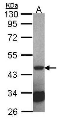 Western Blot: Septin-2 Antibody [NBP1-31496]