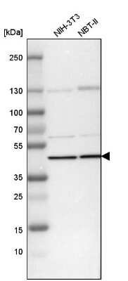 Western Blot: Septin-2 Antibody [NBP1-85212]