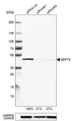 Western Blot: Septin-2 Antibody [NBP1-85212]