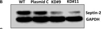 Western Blot: Septin-2 Antibody [NBP1-85212]