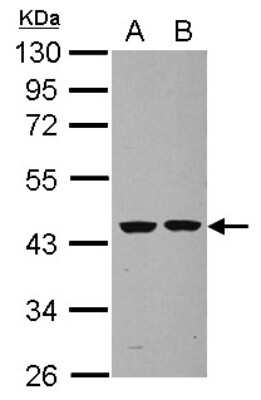 Western Blot: Septin-2 Antibody [NBP2-20301]