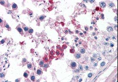 Immunohistochemistry-Paraffin: Septin-3 Antibody [NB100-1023]