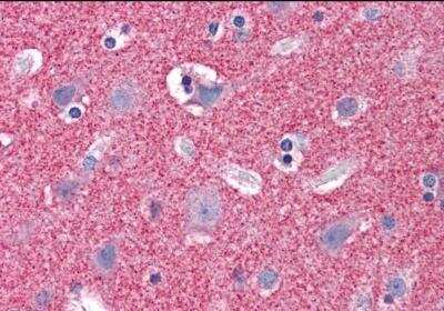 Immunohistochemistry-Paraffin: Septin-3 Antibody [NB100-1023]