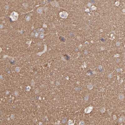 Immunohistochemistry-Paraffin: Septin-3 Antibody [NBP1-90339]