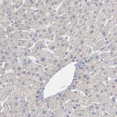 Immunohistochemistry-Paraffin: Septin-3 Antibody [NBP1-90339]