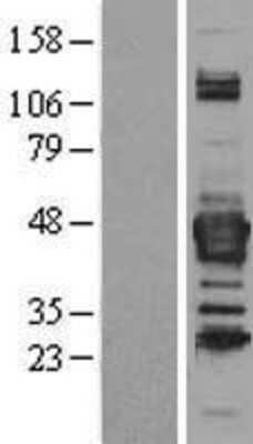 Western Blot: Septin-3 Overexpression Lysate [NBL1-07141]