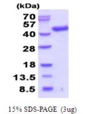 SDS-PAGE: Recombinant Human Septin-3 His Protein [NBP2-51926]