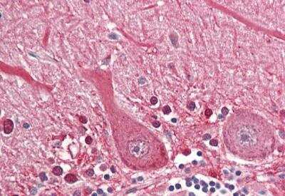 Immunohistochemistry-Paraffin: Septin-4 Antibody [NBP1-52095]