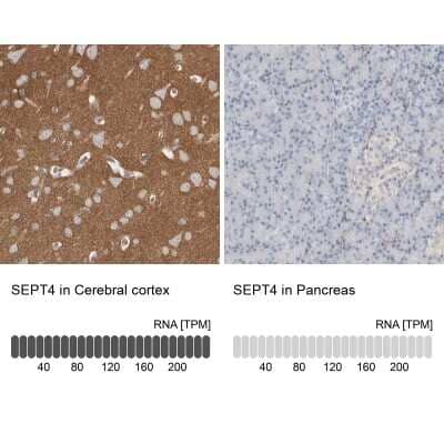 Immunohistochemistry-Paraffin: Septin-4 Antibody [NBP1-90093]