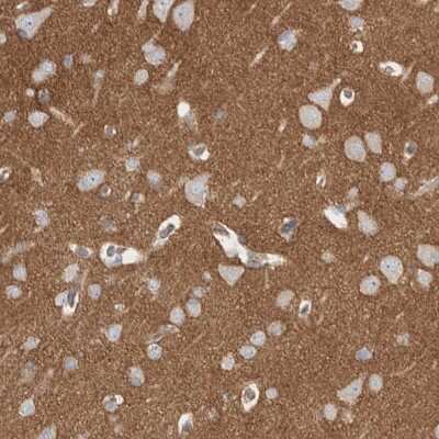 Immunohistochemistry-Paraffin: Septin-4 Antibody [NBP1-90093]